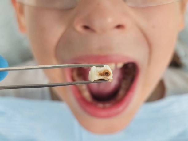 Best Walk-In Emergency Dentist in North Liberty, IA